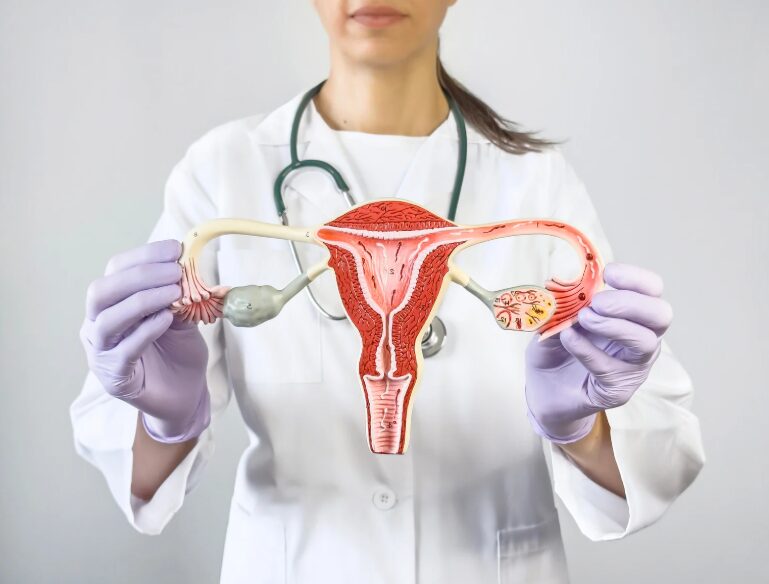 Why Polycystic Ovary Syndrome Matters